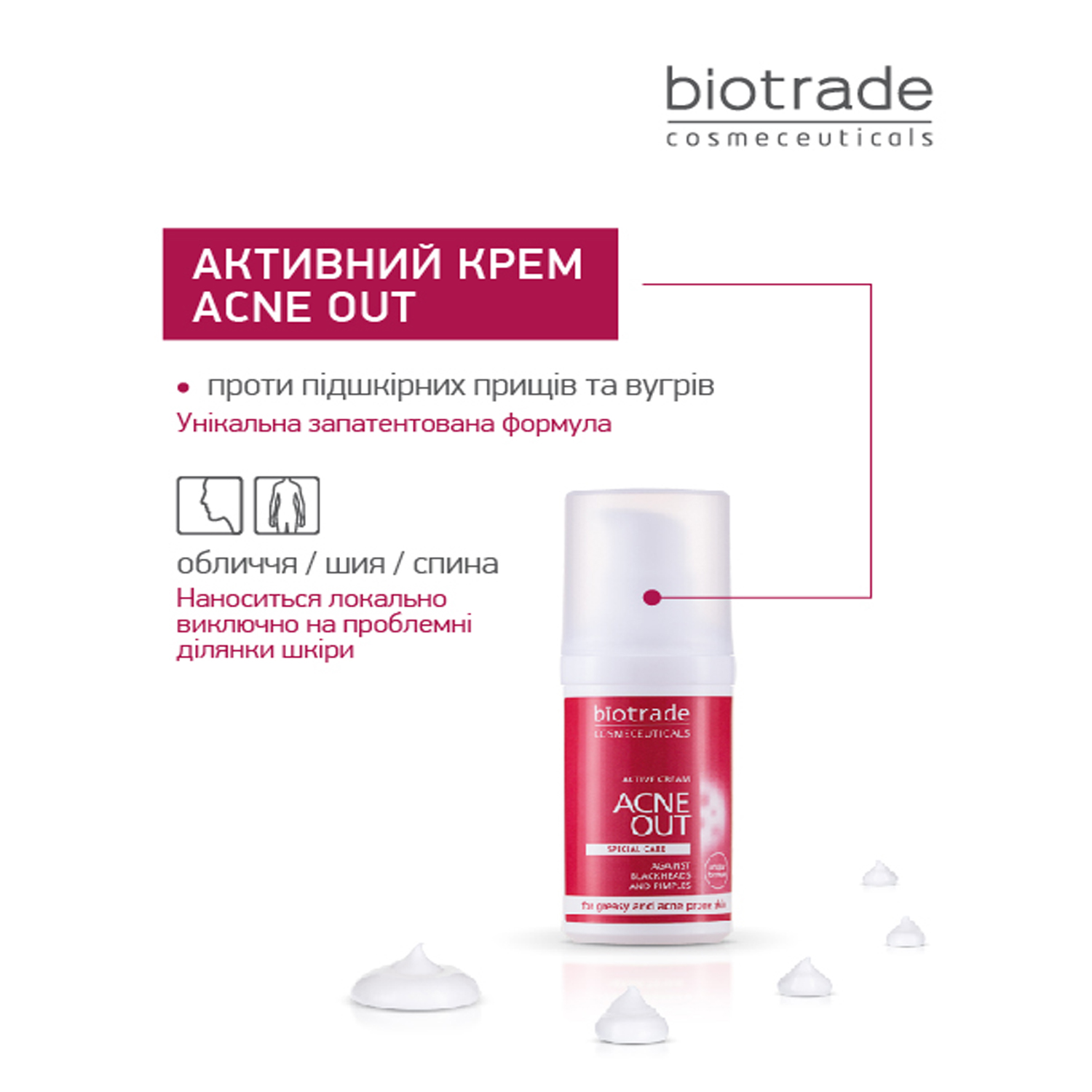 АКТИВНИЙ КРЕМ ACNE OUT / ДЛЯ ПРОБЛЕМНОЇ ШКІРИ З ВУГРАМИ ТА КОМЕДОНАМИ / ЛОКАЛЬНОГО НАНЕСЕННЯ 30 МЛ - Image 4